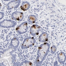 KHNYN Antibody, Novus Biologicals:Antibodies:Primary Antibodies